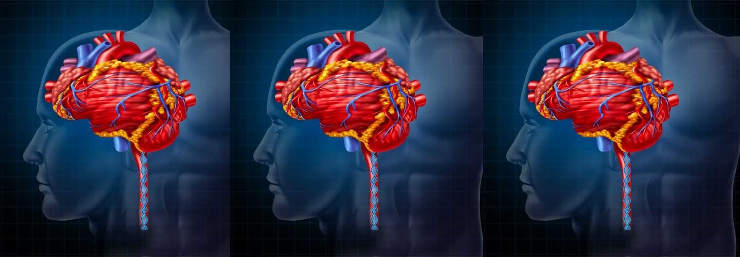 The DNA of Emotional Health – Part 6 Fatty Arteries Make Skinny, Shrinking Brains