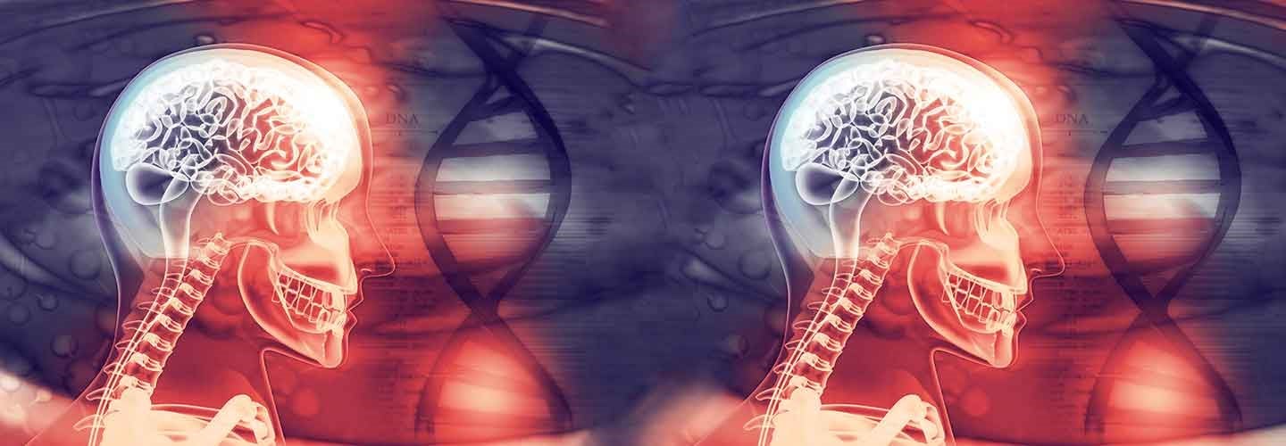 “Genes that Burn Down Your Brain” Extinguish the Fire by Regulating CD33 and TREM2, the “Brain Inflammation Genes” – Part 2